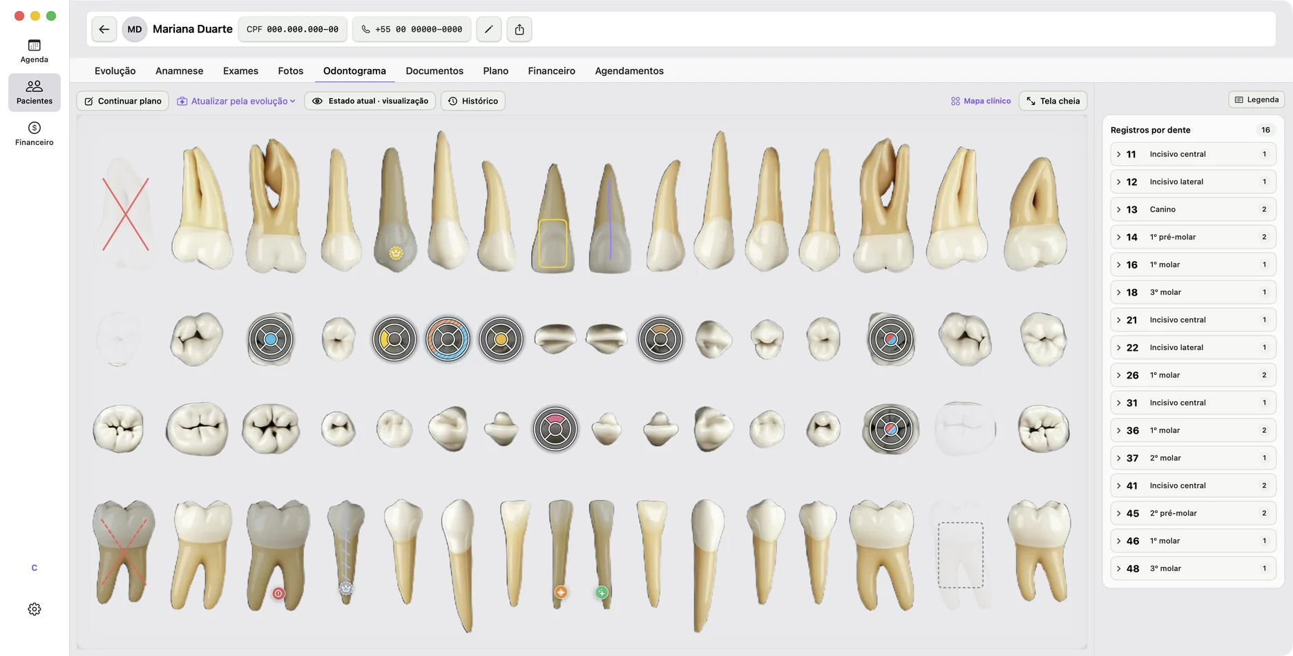 Tela real do odontograma do app no tema claro: dentes renderizados individualmente com condições e procedimentos marcados, e registros por dente ao lado